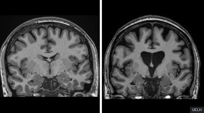 brain slides