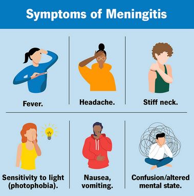 sx of meningitis