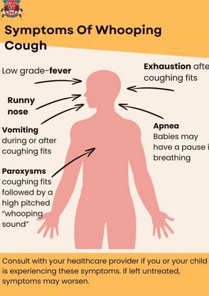 whooping cough