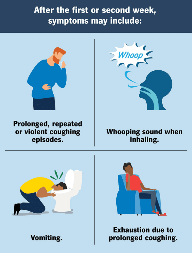 pertussis later symptoms