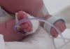 Plastic Additives Tied to Millions of Premature Births and Thousands of Infant Deaths