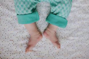 baby with 50 fractures