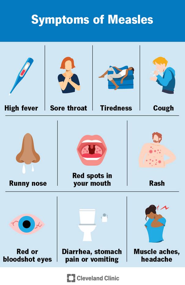 measles symptoms