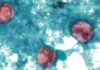 Diarrhea-Causing Parasite Outbreak Spreads Across Multiple States