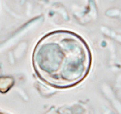 cyclospora