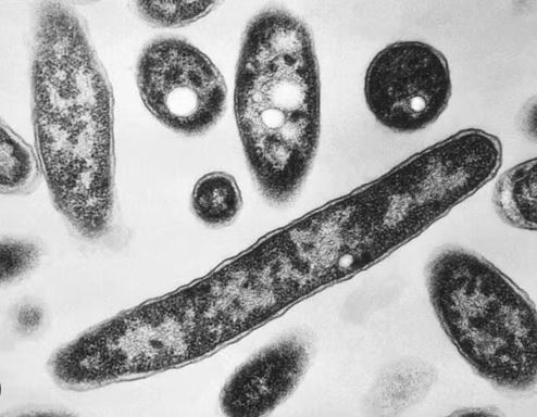 legionella bacteria